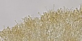 Hyphodontia sambuci image