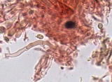 Hyphodontia sambuci image