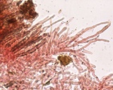 Hyphodermella corrugata image