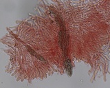 Hyphodermella corrugata image