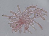 Hyphodermella corrugata image