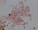 Hyphodermella corrugata image