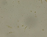 Hyphodermella corrugata image