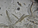 Phaeosphaeriopsis obtusispora image