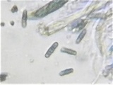 Phaeosphaeriopsis obtusispora image