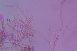 Athelia bombacina image