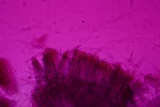 Tarzetta cupularis image