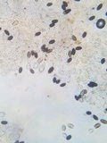 Parasola conopilea image