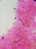 Parasola conopilea image