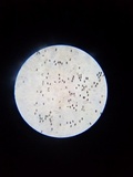 Parasola conopilea image