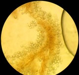 Hydnangium carneum image