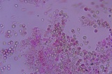 Dichostereum effuscatum image