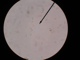 Peziza phyllogena image