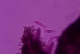 Patellaria atrata image