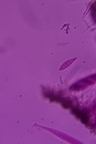 Patellaria atrata image