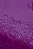 Athelia acrospora image