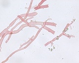 Phanerochaete calotricha image