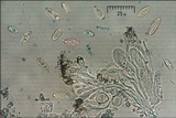 Caloplaca ochracea image