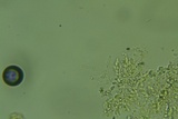 Sistotrema brinkmannii image