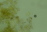 Sistotrema brinkmannii image