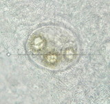 Tuber aestivum image
