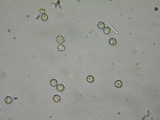 Dichostereum rhodosporum image