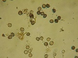 Dichostereum rhodosporum image