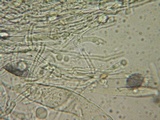 Aleurodiscus grantii image