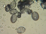 Aleurodiscus grantii image