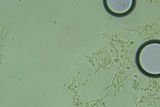 Lyomyces erastii image
