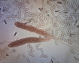 Cryptovalsa protracta image