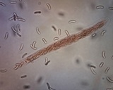 Cryptovalsa protracta image
