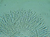 Lachnellula calyciformis image