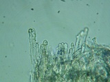 Lachnellula calyciformis image