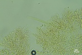 Kneiffiella alienata image