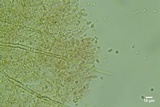 Kneiffiella alienata image