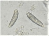 Thaxteriella pezizula image