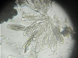 Thaxteriella pezizula image