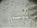 Thaxteriella pezizula image
