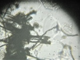 Thaxteriella pezizula image