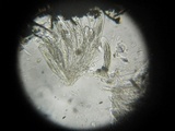 Thaxteriella pezizula image