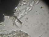 Thaxteriella pezizula image