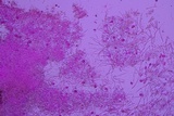 Sebacina epigaea image