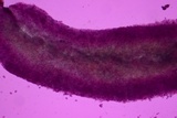 Sebacina epigaea image