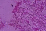 Sebacina epigaea image