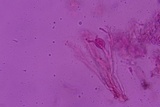 Sebacina epigaea image