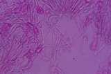 Sebacina epigaea image