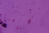 Sebacina epigaea image