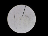 Lycogala epidendrum image