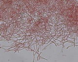 Stromatoscypha fimbriata image